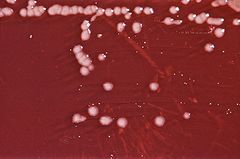 an image of the Pseudomonas Aeruginosa bacteria